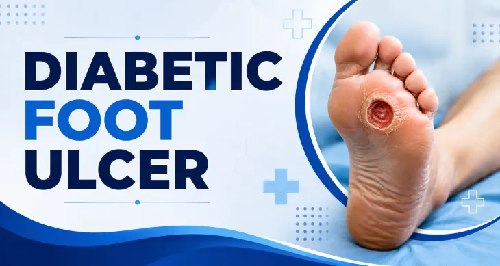 diabetic foot ulcer 