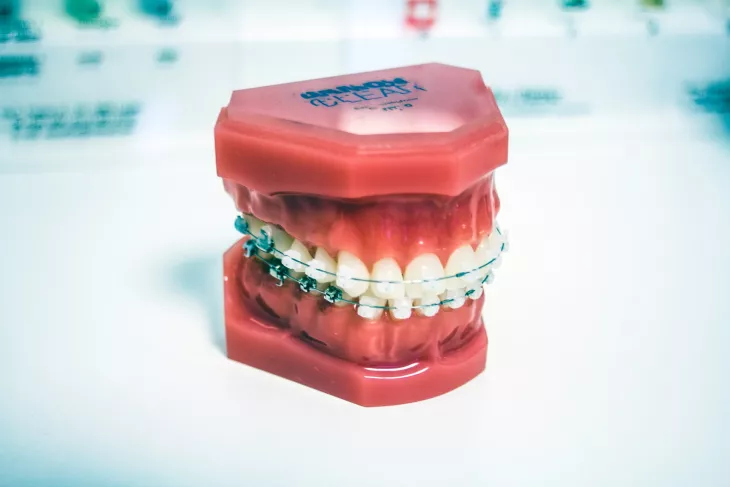 Invisible Braces