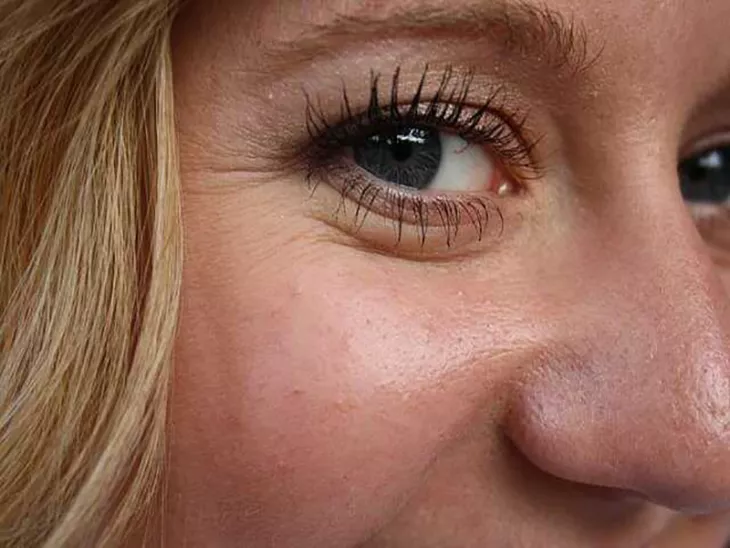 delay appearance wrinkles on face