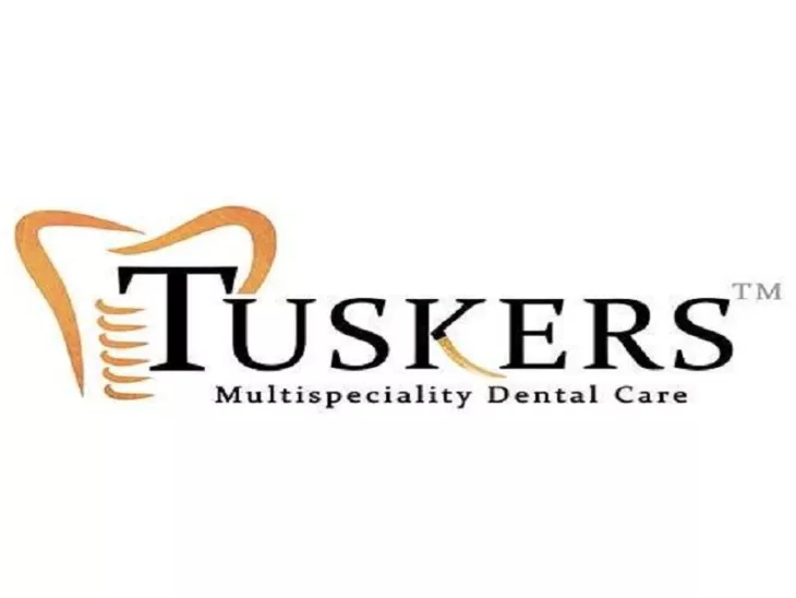 Tuskers Multispeciality Dental Care is highly advanced yet affordable dental clinic in Ahmedabad. We offer everything from basic dental cleaning, Filling, Dental Surgery, Advanced cosmetic dentistry also provide RCT to dental implants in Ahmedabad. 