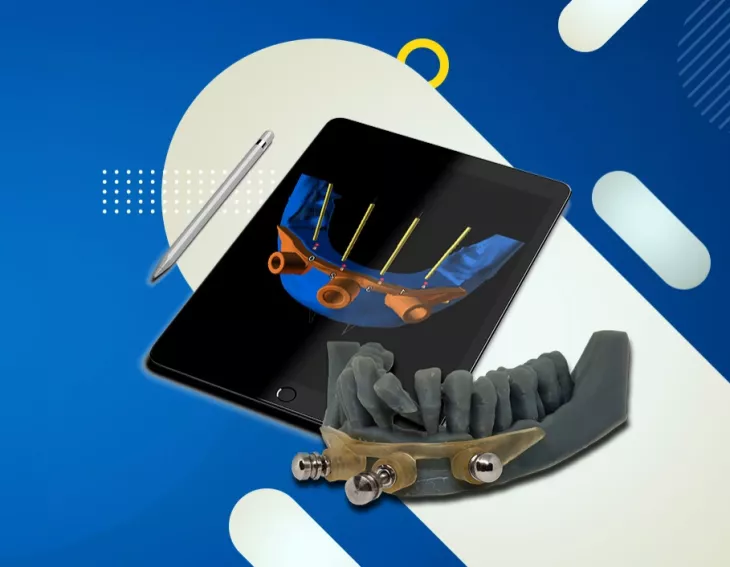Guided Surgery