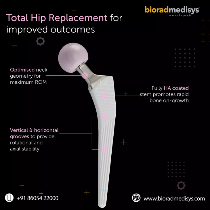 Orthopedic implants