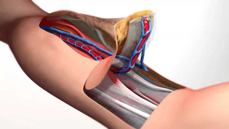 Varicose veins rarely require treatment for health reasons, but if there is swelling, pain, and pain in the feet, and if there is considerable discomfort, then healthcare treatment is available.