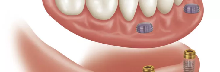 Dental image