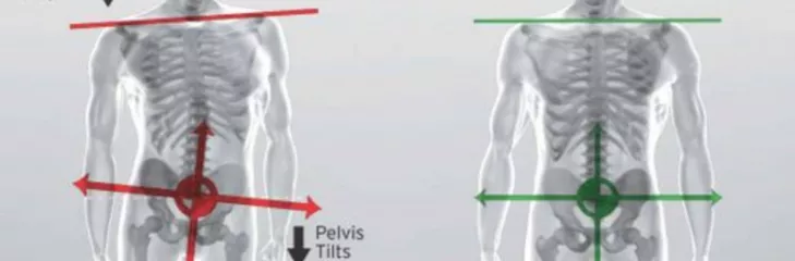 lower back pain relief services in Fargo, ND