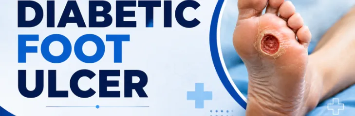 diabetic foot ulcer 