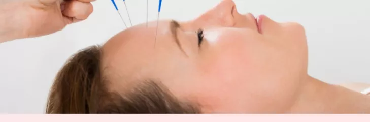 How does acupuncture relieve pain