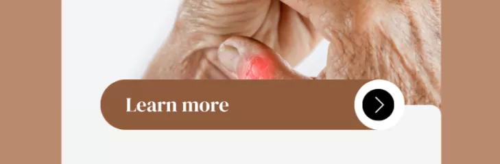 rheumatologic diseases, types of rheumatic problems