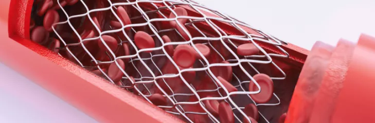 Angioplasty