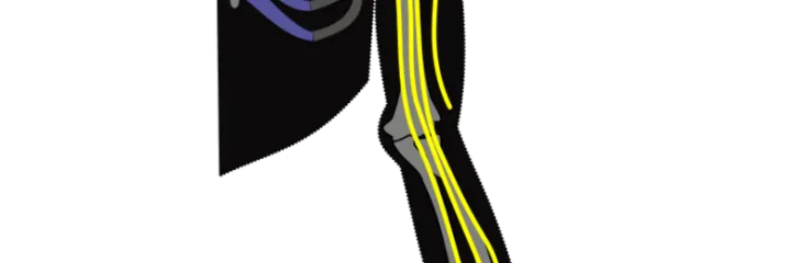 Top Brachial Plexus hospital in India