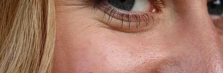 delay appearance wrinkles on face