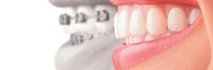 We're the top dental clinic for dental braces Dubai! 