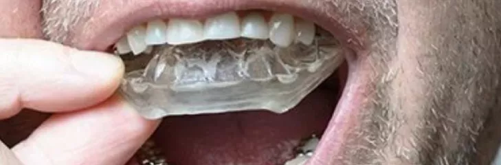 custom mouthguards