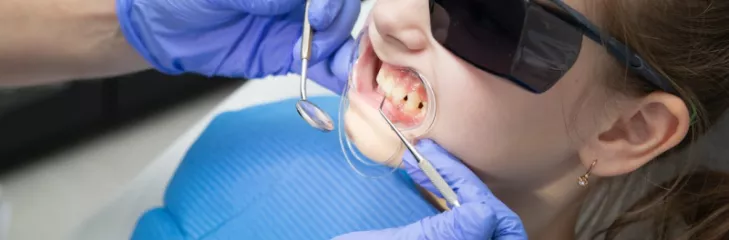 fluoride treatment for kids