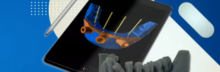 Guided Surgery