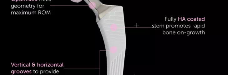 Orthopedic implants