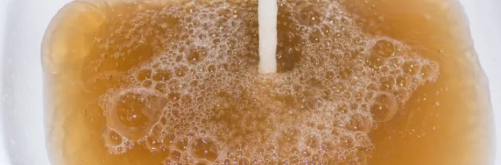 Water Well Problems