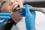 Dental Filling Price Singapore