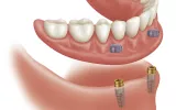 Dental image