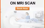 mri scan in delhi