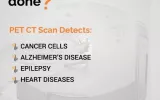 pet ct scan in delhi