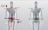lower back pain relief services in Fargo, ND