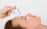 Acupuncture Culver City