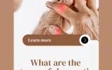 rheumatologic diseases, types of rheumatic problems