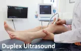 Duplex ultrasound is a non-invasive evaluation of blood flow through your arteries and veins.