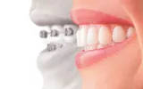 We're the top dental clinic for dental braces Dubai! 