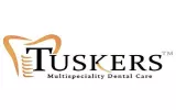 Tuskers Multispeciality Dental Care is highly advanced yet affordable dental clinic in Ahmedabad. We offer everything from basic dental cleaning, Filling, Dental Surgery, Advanced cosmetic dentistry also provide RCT to dental implants in Ahmedabad. 