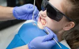 fluoride treatment for kids