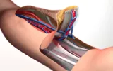 Varicose veins rarely require treatment for health reasons, but if there is swelling, pain, and pain in the feet, and if there is considerable discomfort, then healthcare treatment is available.